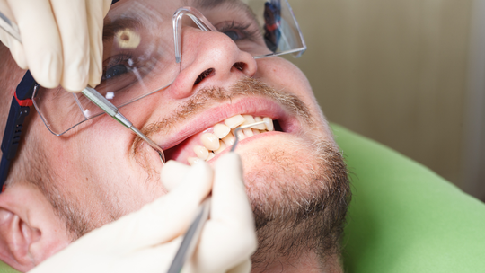 Do dentysty w Ukrainie. To tam Polacy coraz częściej leczą zęby