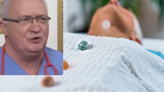Lex szarlatan zamrożone przez prezydenta. Prof. Krzysztof Simon ostrzega przed oszustwami w medycynie